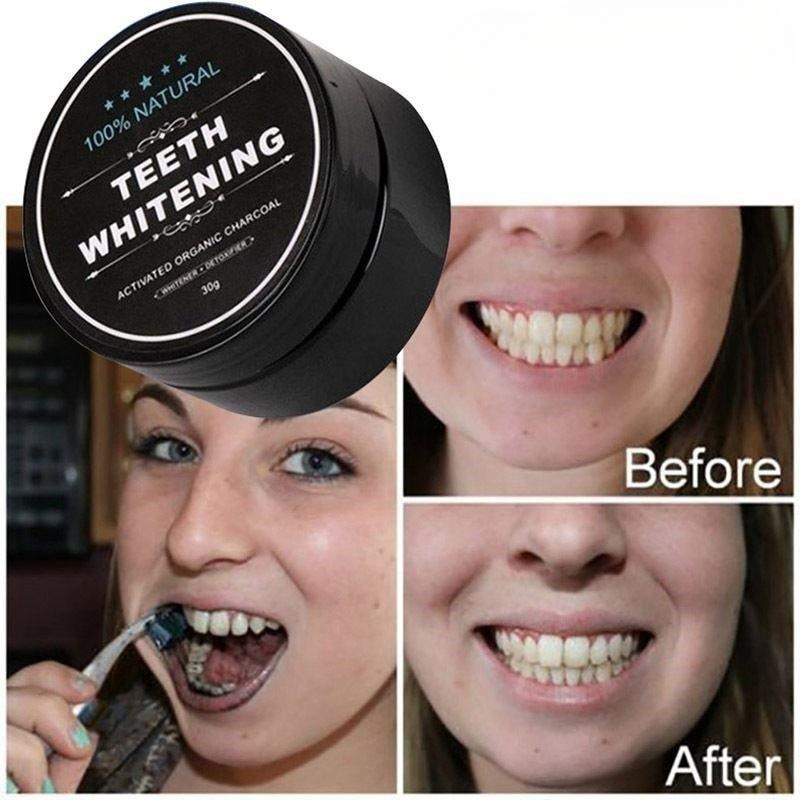 1 صندوق من مسحوق تبييض الأسنان - مراجعة Teeth Whitening Pens وسعره